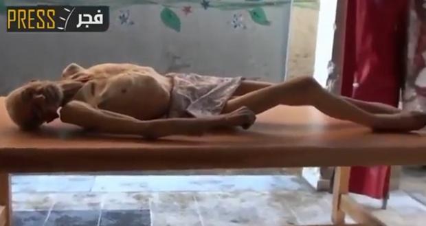 Un’immagine presa da un video che mostra un palestinese che, a quel che si dice, sarebbe morto di disidratazione nel campo per rifugiati di Yarmouk, nei pressi di Damasco, sotto assedio da parte delle forze governative.